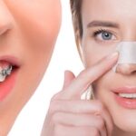 ارتودنسی چیست و چه تغییری ایجاد می‌کند؟