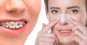 ارتودنسی چیست و چه تغییری ایجاد می‌کند؟