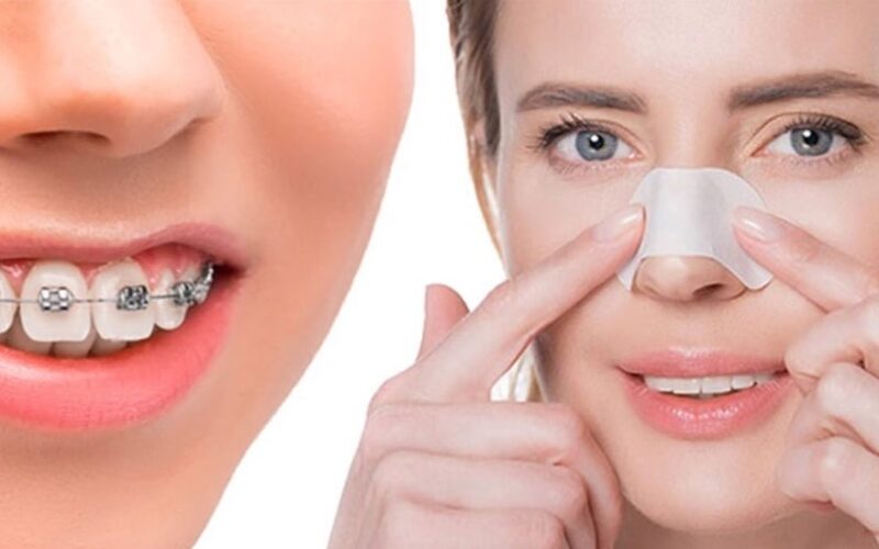 ارتودنسی چیست و چه تغییری ایجاد می‌کند؟