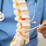 ویژگی بهترین دکتر سیاتیک ؟